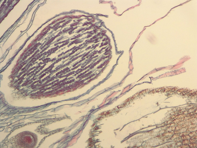 Liverwort Sporophyte Slides - Liverwort Sporophyte 02 100X